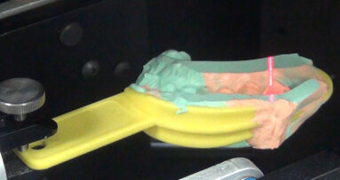 La CFAO dentaire facile au fauteuil avec le scan d’empreinte silicone
