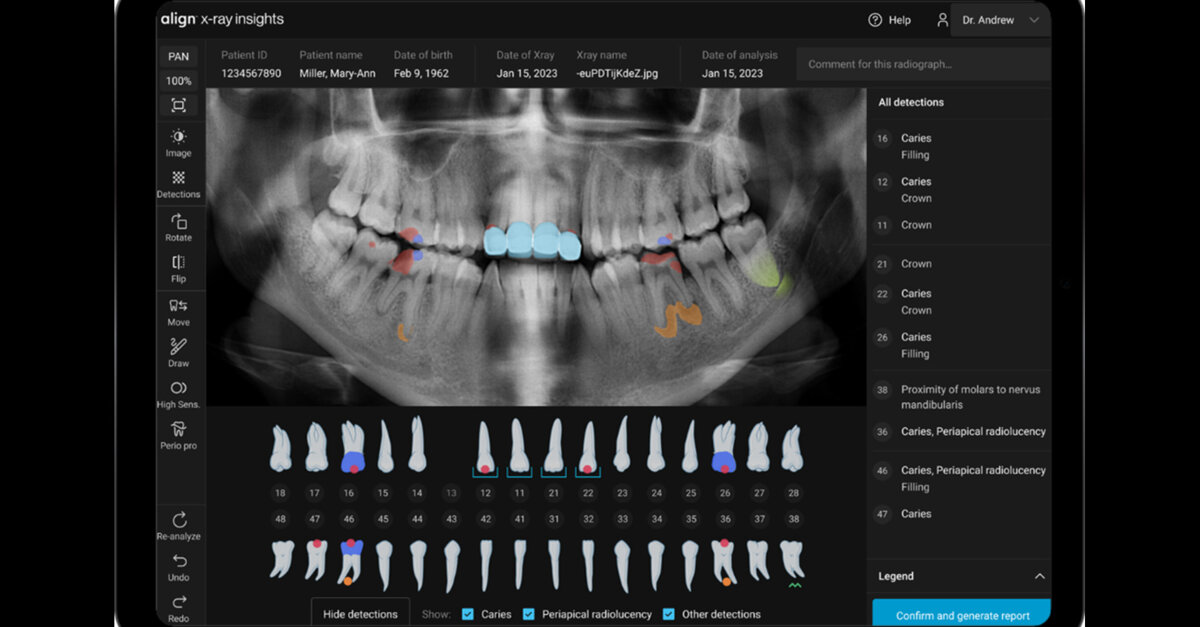 New dental software from Invisalign Align Technology