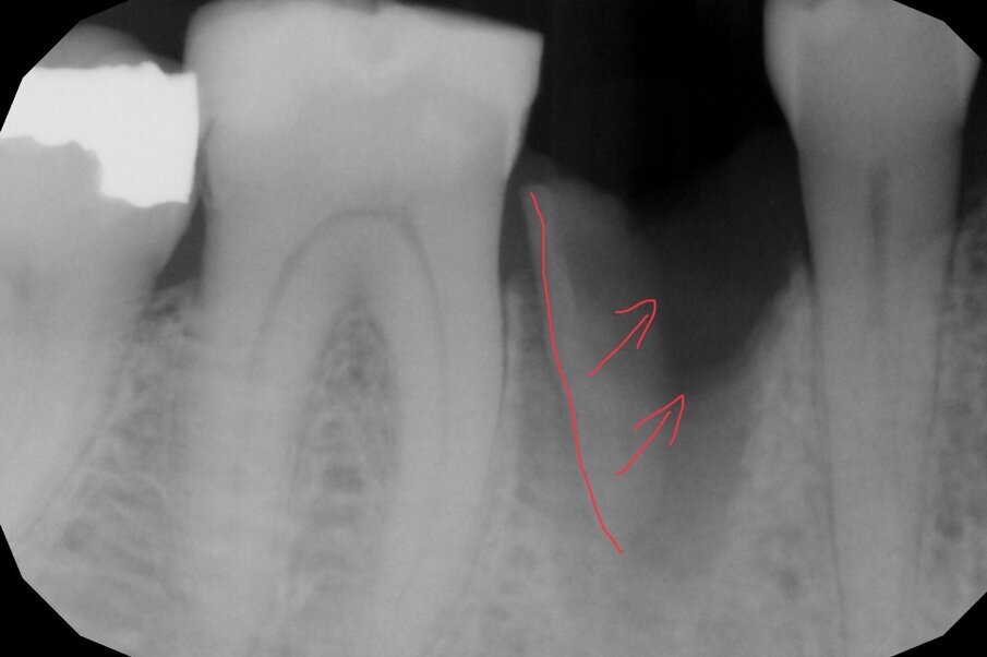 Fig. 3b