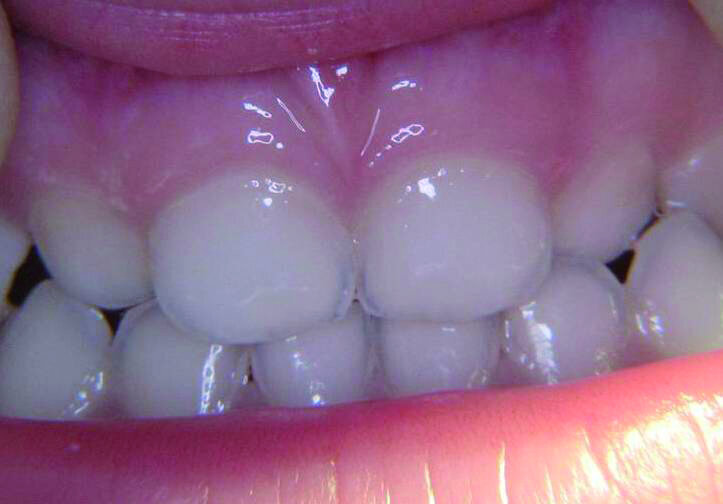 Figure 14b
