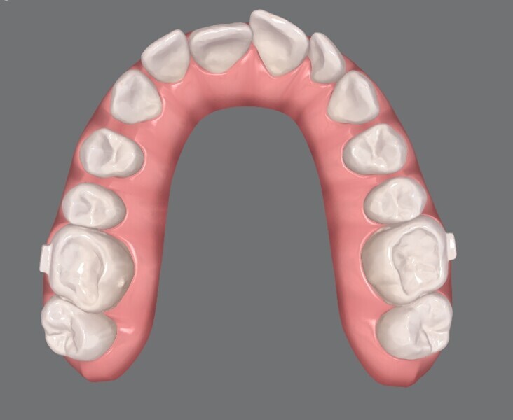 Fig. 7c