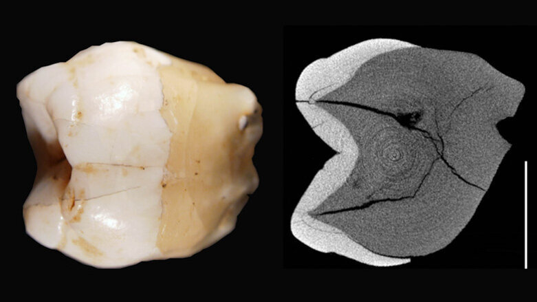 Discovery of fossilised teeth in Indonesia stirs up old debate