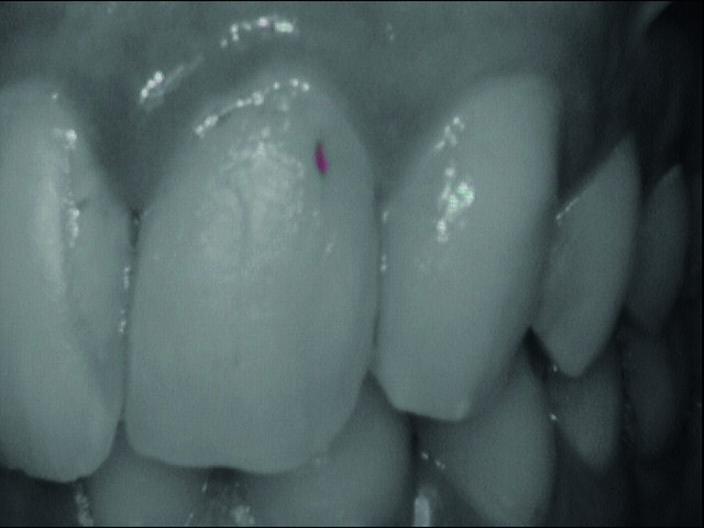 Fig. 2f