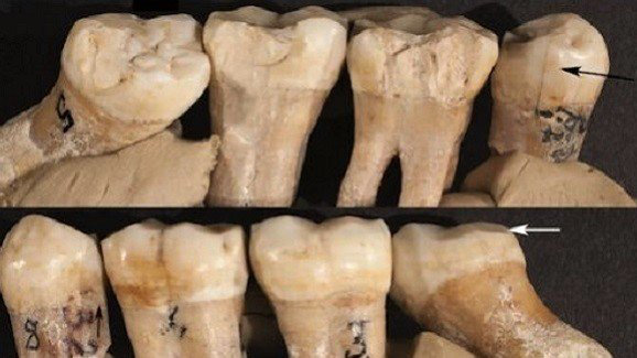 Hallan signos de odontología prehistórica en el Hombre de Neandertal