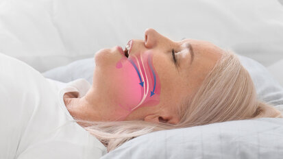 Diagnosi precoce dell’OSAS nella pratica clinica quotidiana: il ruolo dell’igienista dentale