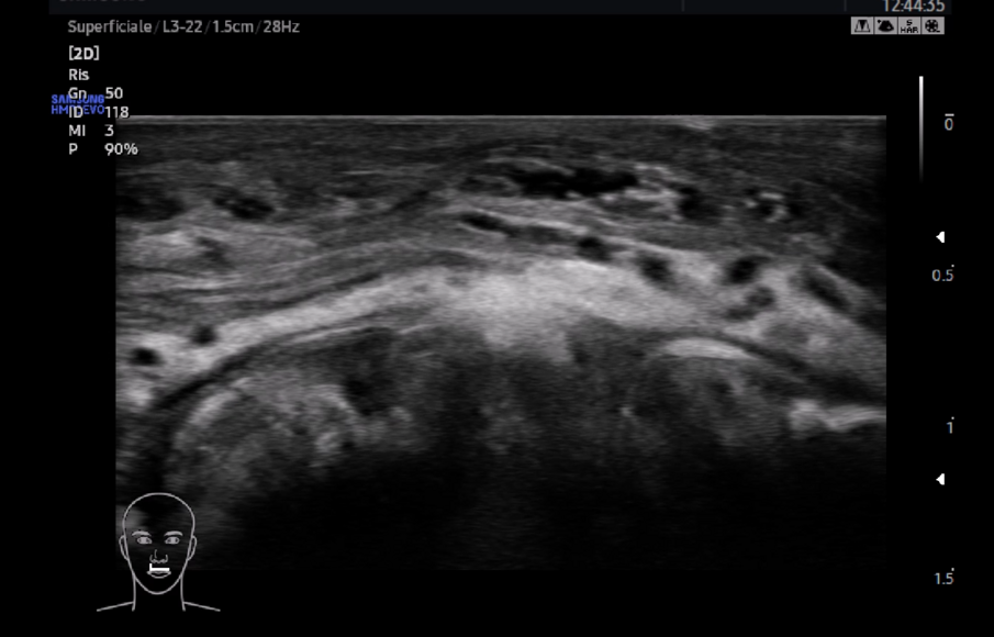 Fig. 11