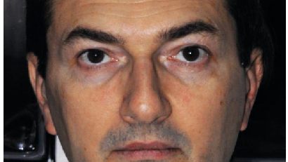 Intervista a Mario Semenza sulla rilevazione delle impronte di precisione con i materiali di nuova generazione