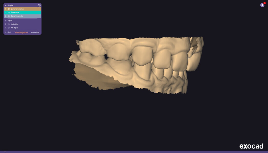 Fig. 2b