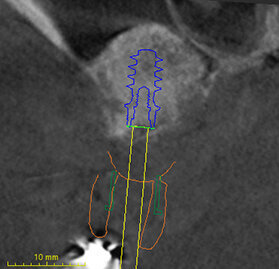 Fig. 39