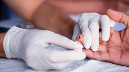 Study investigates chairside HIV testing in London dental clinics