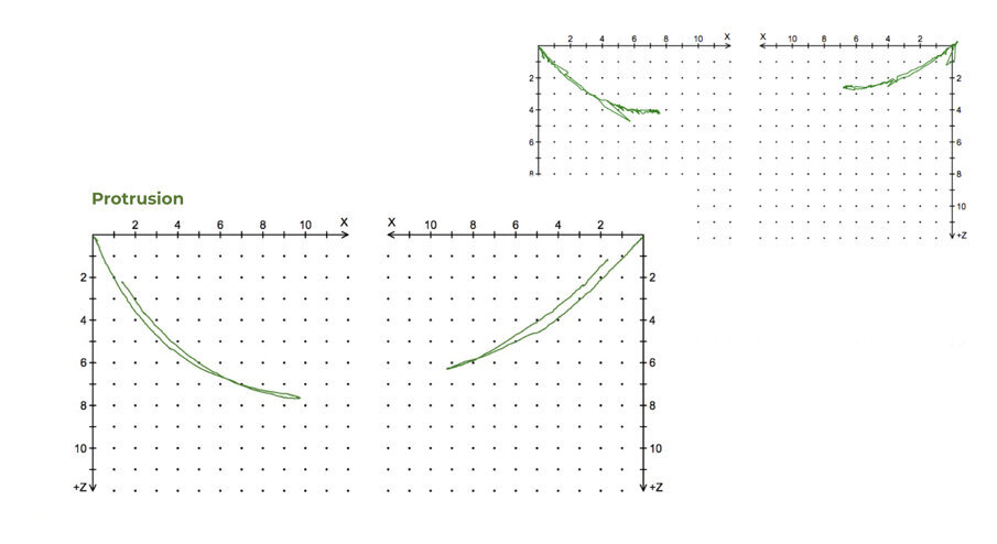 Fig. 43