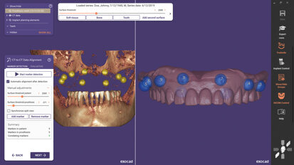 Exocad releases exoplan 3.0 Galway software in the US