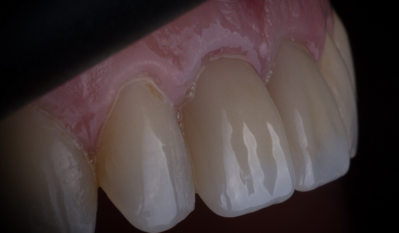 Fig. 13: Natural surface texture contributing to the successful outcome. (Image: Emmanuel Charleux)