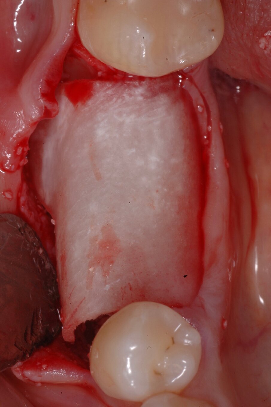 Fig. 9
