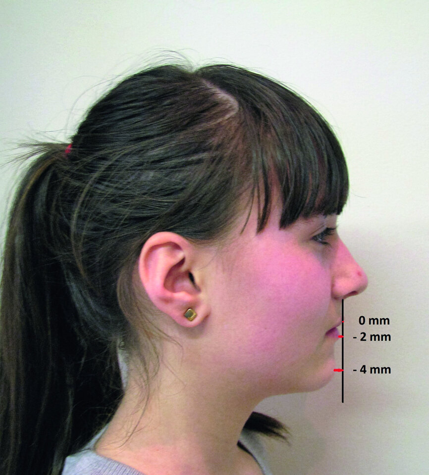 Fig. 10