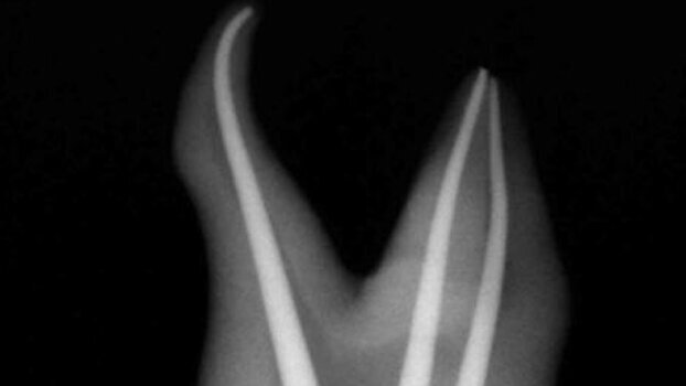 Dental Tribune Study Club develops clinicians’ skills via case studies database