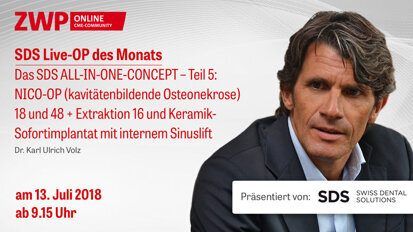 Live-OP am 13. Juli: „Das SDS ALL-IN-ONE-CONCEPT – Teil 5“
