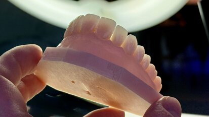 Milling or printing? The reliable path to definitive restorations