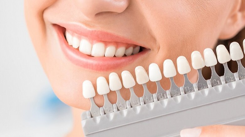 Researchers develop less destructive method to whiten teeth