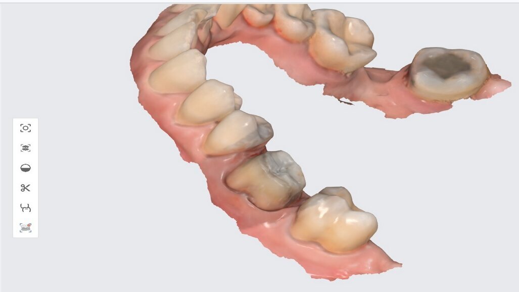 3D tisk ve stomatologii: Tajemství, jak nabídnout více za méně
