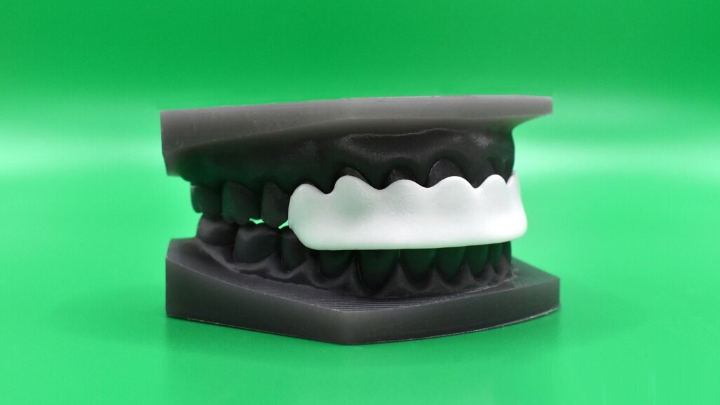 Nueva férula de reposicionamiento mandibular