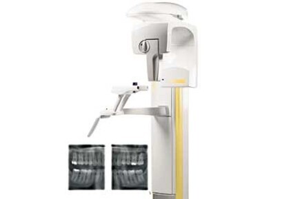 Planmeca ProMax S3: Capture interproximal caries extraorally