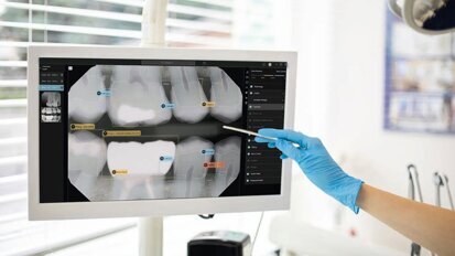 La revolución de la IA en la Odontología