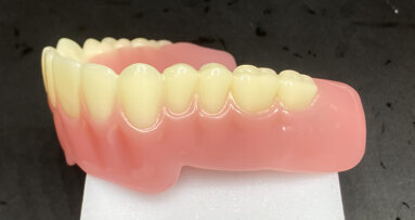 New 3D-printed denture solution available in the US