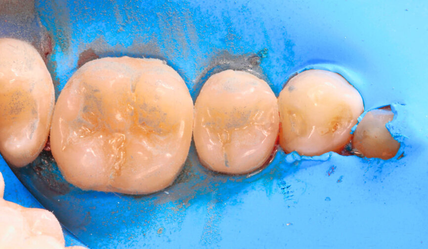 Fig. 7: The light-blue TWIST DIA for Composite rubber spiral is used to achieve a mirror-like gloss.