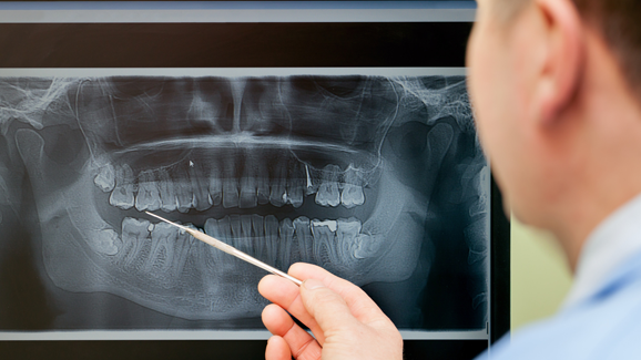 Neues SSO-Skript „Orale Chirurgie“ auch in italienischer Sprache