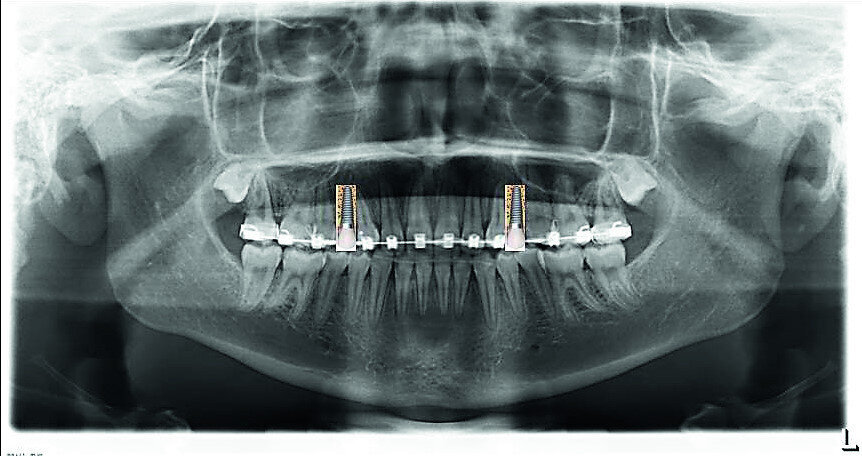 Fig. 32