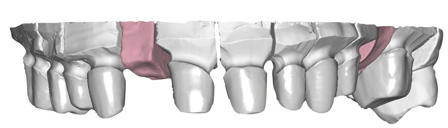 Fig. 49