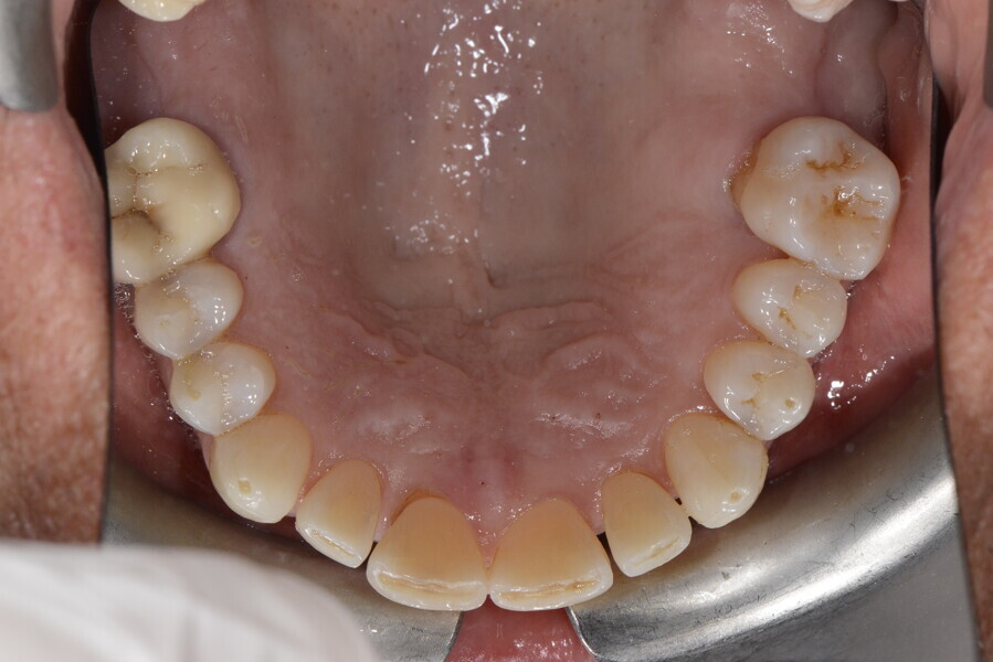 Fig. 19d