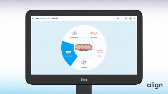 Align Technology: nuove soluzioni per il dialogo con i pazienti e l’efficienza degli studi