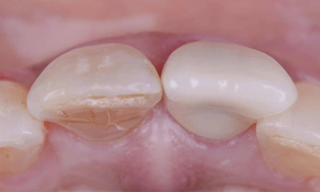 Fig. 4