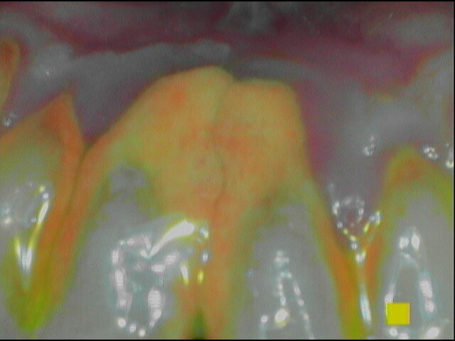 Fig. 2e