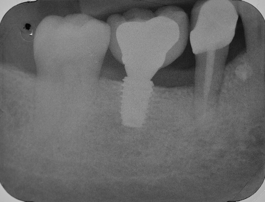 Fig. 29
