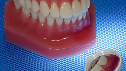 CDC: Half of American adults have periodontal disease