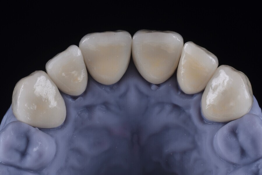 Fig. 14b.