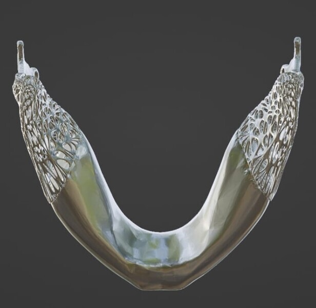 Fig 1h