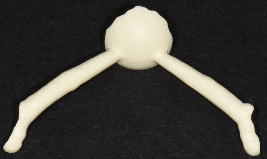 Fig. 26_Nance in Trilor.