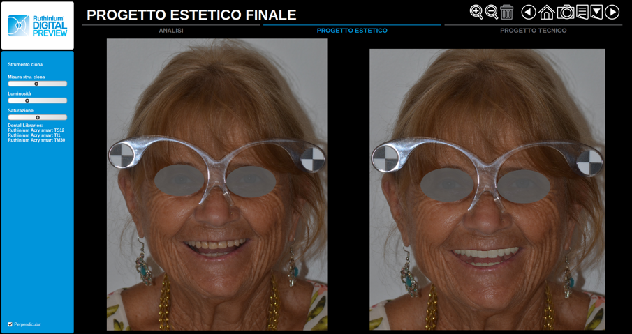 Fig. 4 - Il prima e il dopo è qualcosa che il paziente vede ed è libero di decidere se accettare, modificare o bocciare il risultato, quindi in un certo senso si sente coinvolto partecipando più attivamente al progetto.
