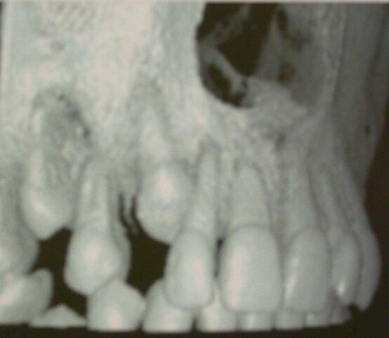 Fig. 9