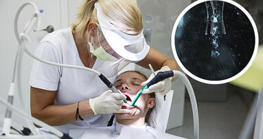Cavitación para eliminar el biofilm de los implantes