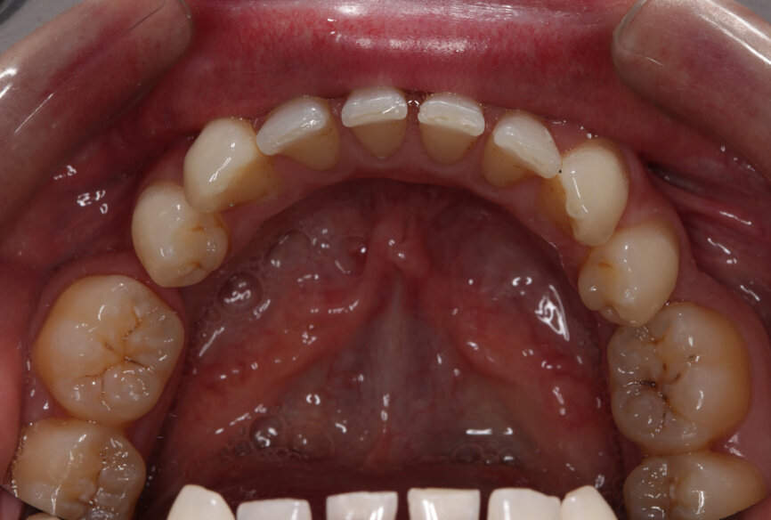 Fig. 18: Post-treatment lower occlusal view