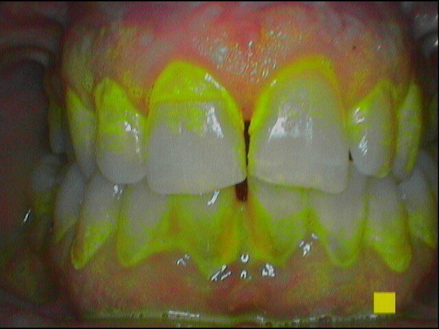 Fig. 2b