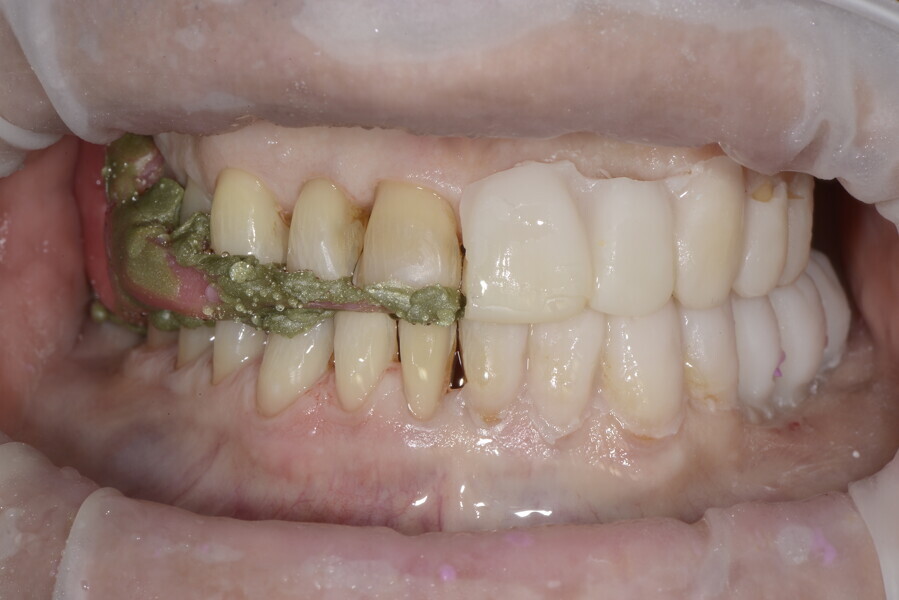 Fig. 24b