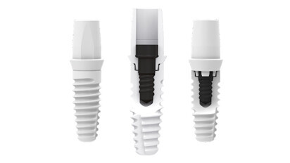 ZERAMEX XT: Root-shaped implant with internal connection