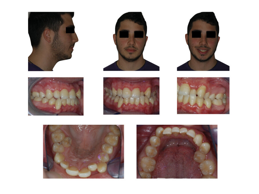 Fig. 1