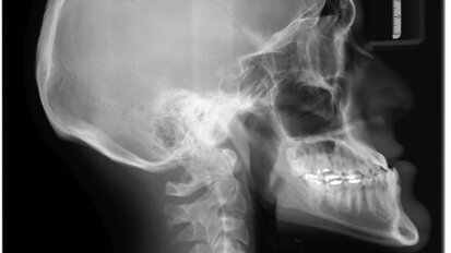 Obrazowanie 2D w stomatologii – kurs dla lekarzy dentystów